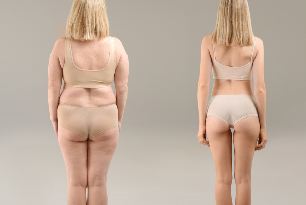 Weight Loss And Self Esteem