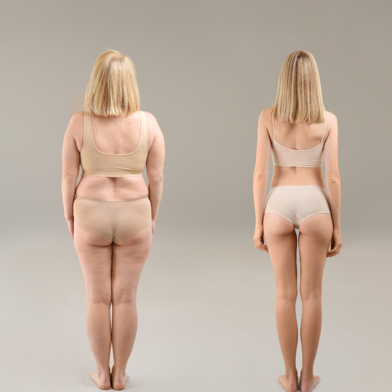 Weight Loss And Self Esteem